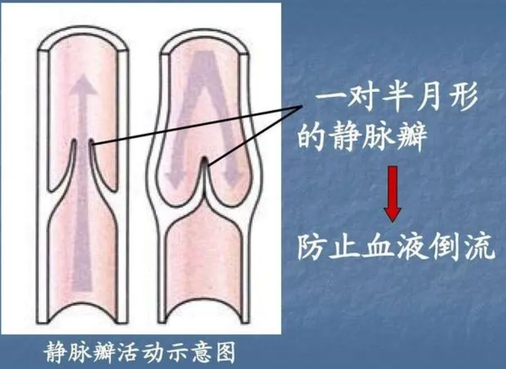 静脉曲张瓣膜